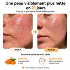 Cotons Éclat Unifiant au Curcuma