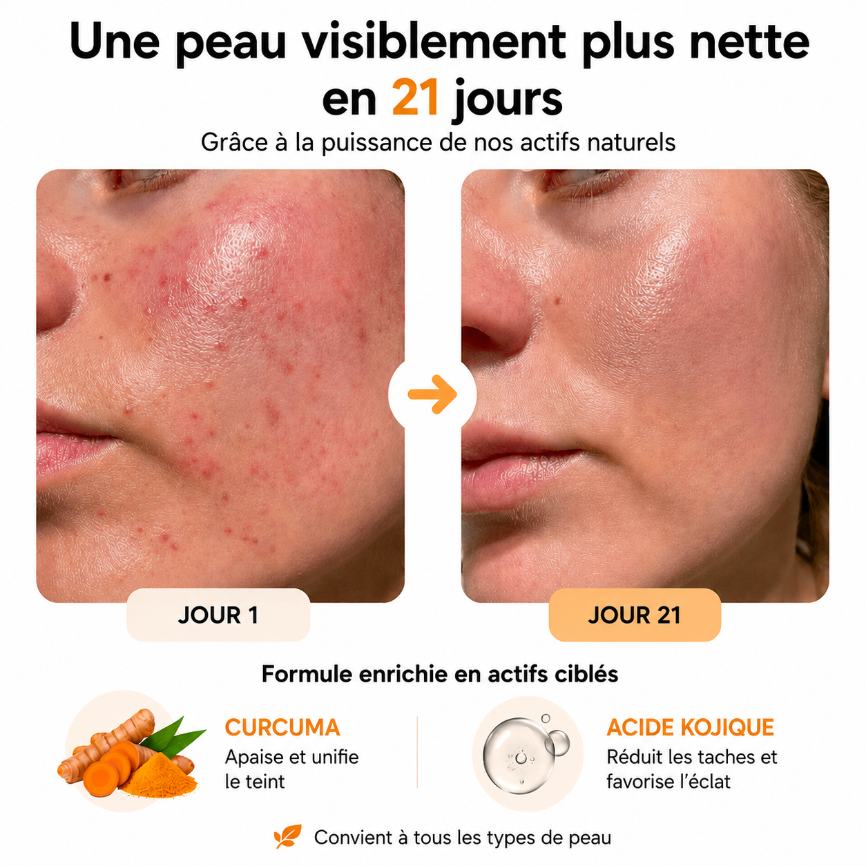 Cotons Éclat Unifiant au Curcuma